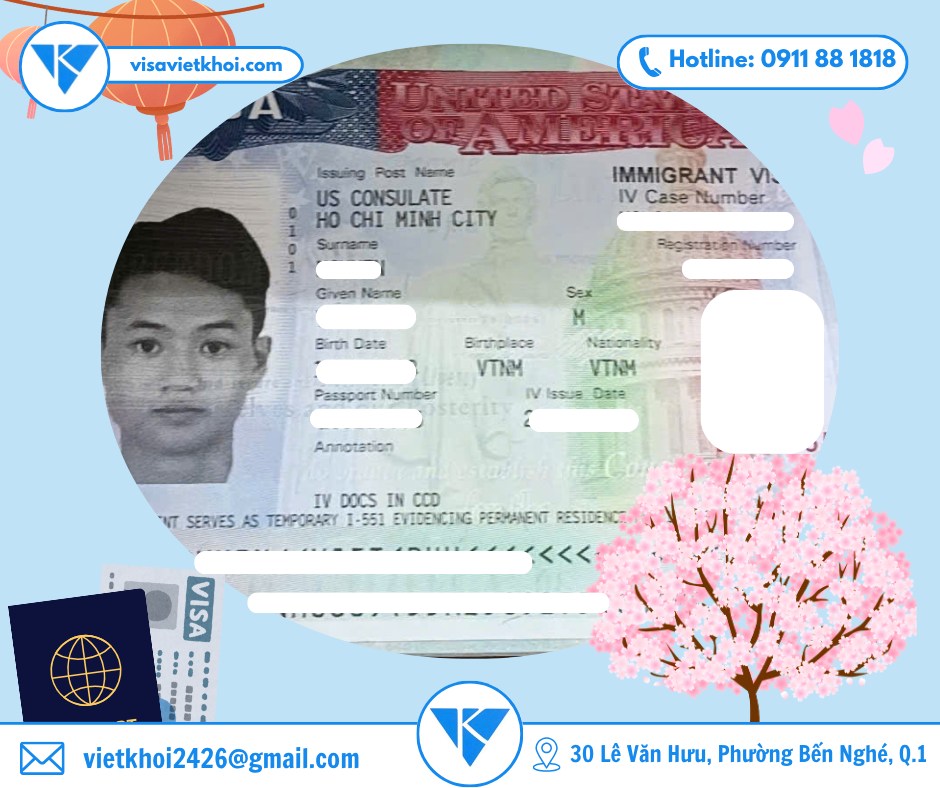 tu van visa 30